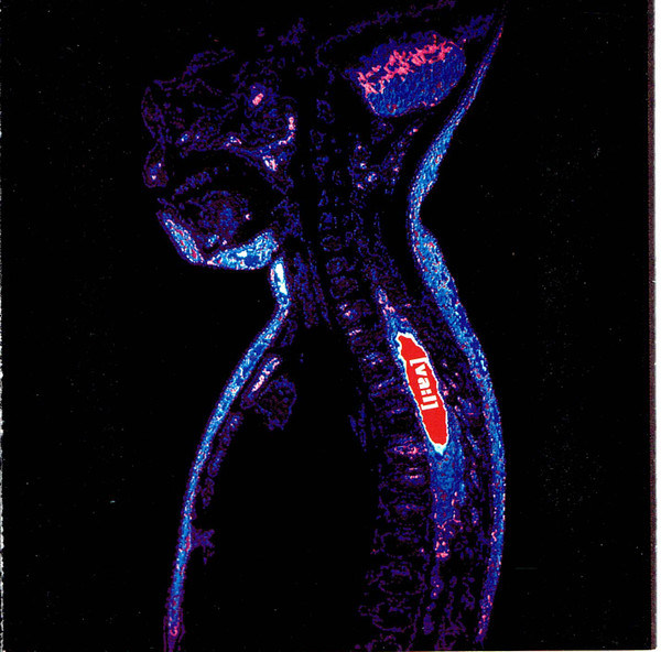 Intricate (2) - [va:l] (CD, Album)